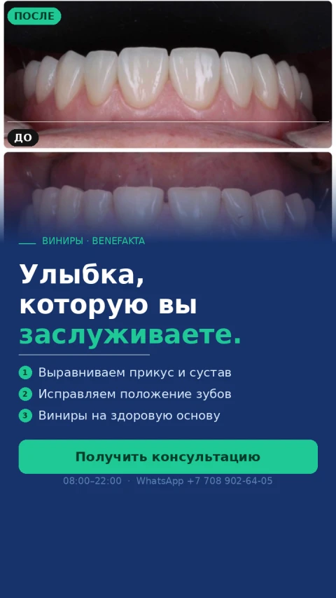 Улыбка, которую вы заслуживаете